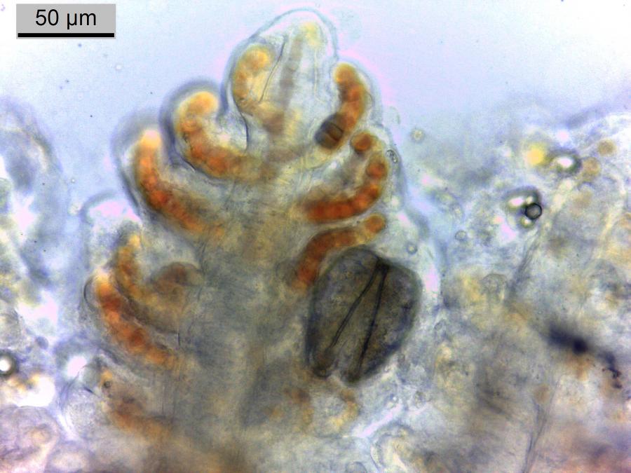 Detalle microscópico dun gloquidio ancorado ao filamento branquial dun salmón: FOTO: CoPeMol