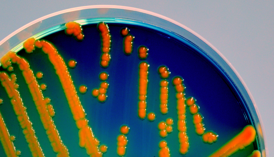 A Escherichia coli pode causar infeccións intestinais e extraintestinais en humanos e animais