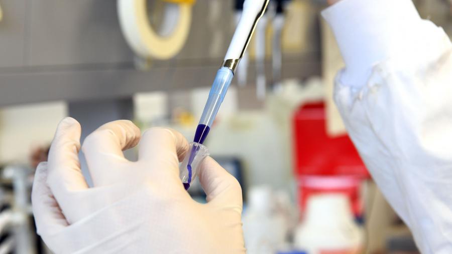 Os investigadores conclúen que os resultados proporcionan información nova sobre os cambios da  fosforilación  plaquetaria relacionados coa obesidade. FOTO: Santi Alvite