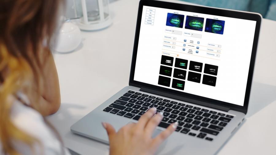 Nun test de uso realizado por profesionais da Odontoloxía, estes recoñeceron que o software  DenTiUS  Plaque podería ser unha ferramenta moi útil para a cuantificación dos niveis de placa dental