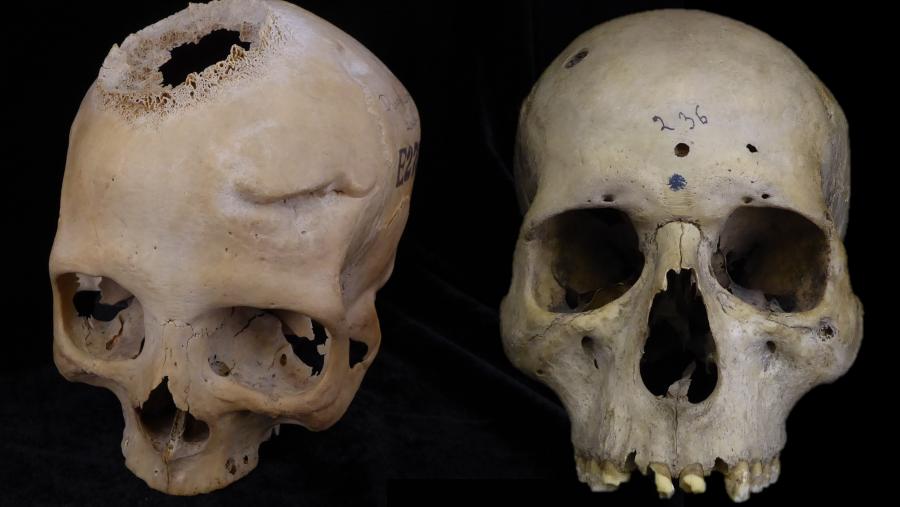 Mostra dos cranios analizados polos investigadores Mostra dos cranios analizados polos investigadores