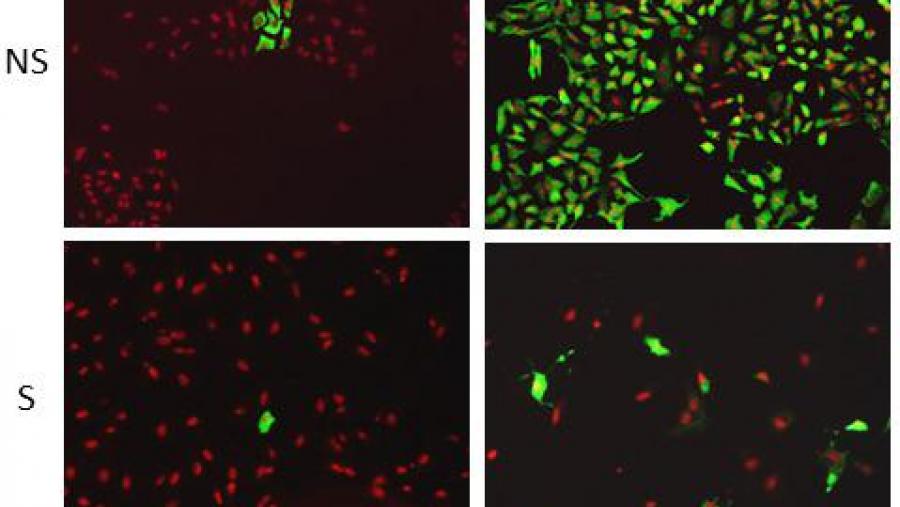 Células non senescentes (NS) mostran un maior grao de infección inicial (virus en verde) que progresa de forma eficiente a todas as células tras 24 horas (en vermello). As células senescentes (S)... Células non senescentes (NS) mostran un maior grao de infección inicial (virus en verde) que progresa de forma eficiente a todas as células tras 24 horas (en vermello). As células senescentes (S)...